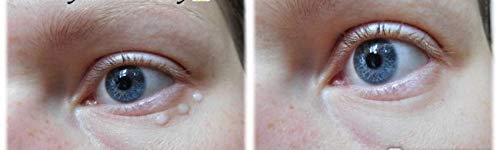 Linija Bielita & Vitex Pharmacos pomlađivanje Svjetlucavog hranjivog kompleksa za oči konture očiju očiju, za sve tipove kože, 20 ml