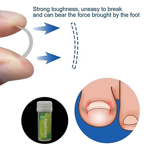 10pcs korekcija na noktima oporavak, urastanje noktiju za nokte naljepnica naljepnica za korektor pedikure alat za ispravljanje noktiju